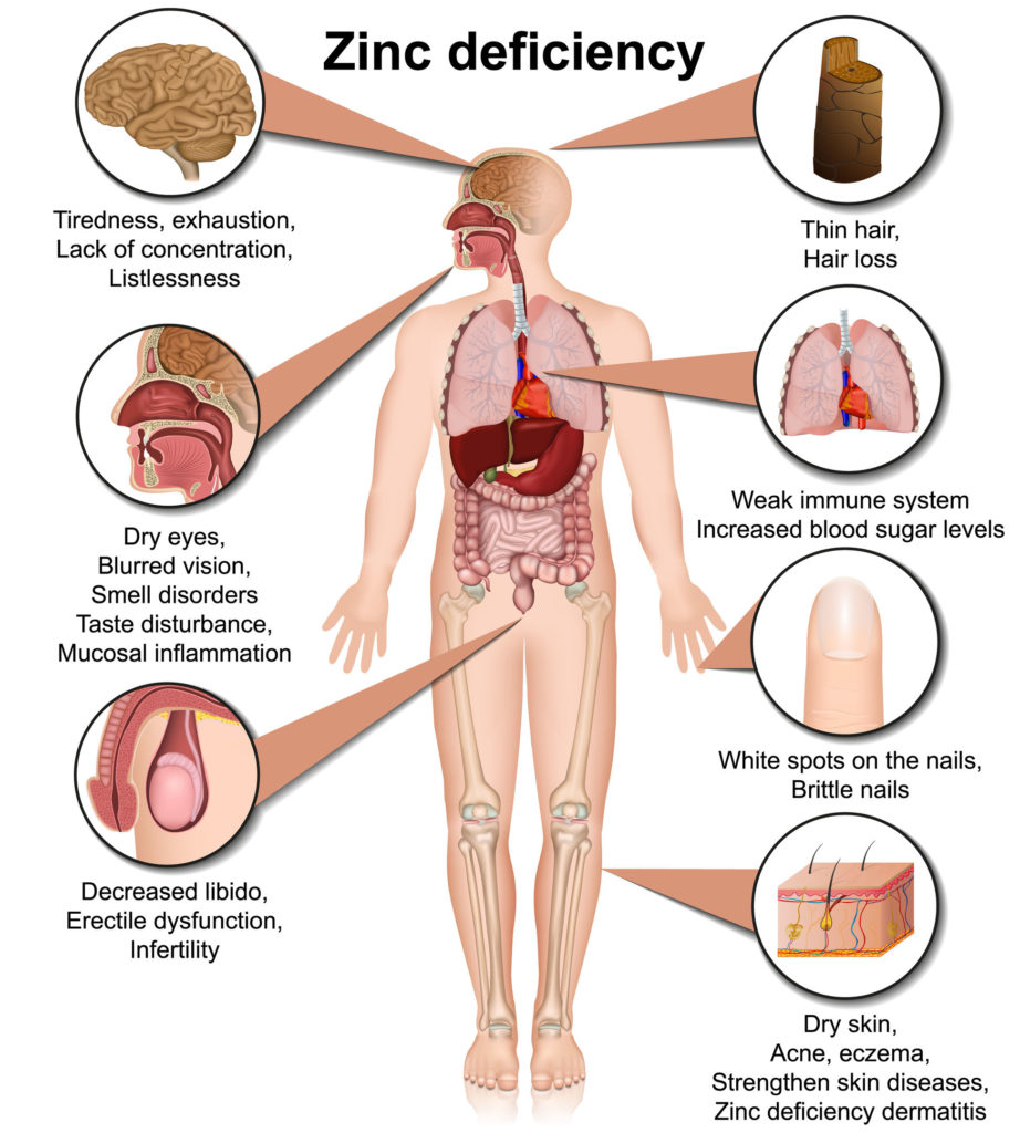 zinc defeciency symptoms